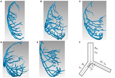 Bifurcation Asymmetry of Small Coronary Arteries in Juvenile and Adult Mice